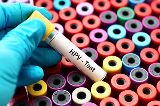 HPV-test