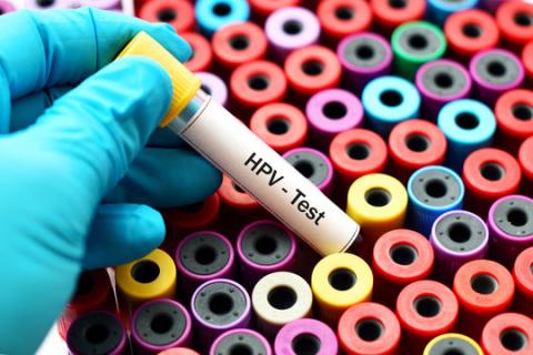 HPV-test