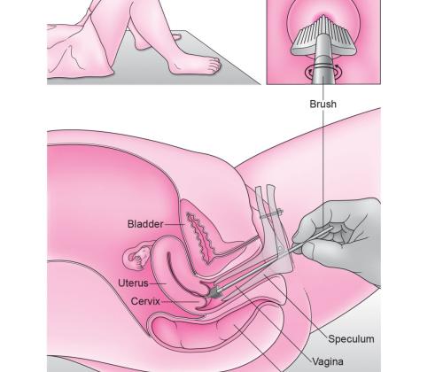 hpv test