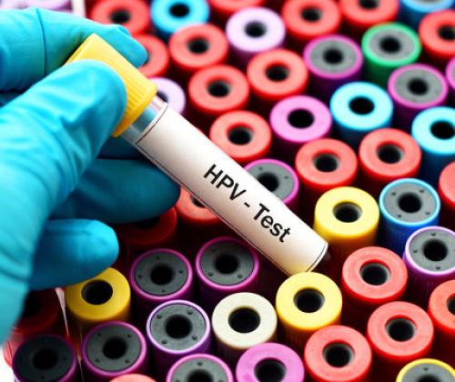 HPV-test